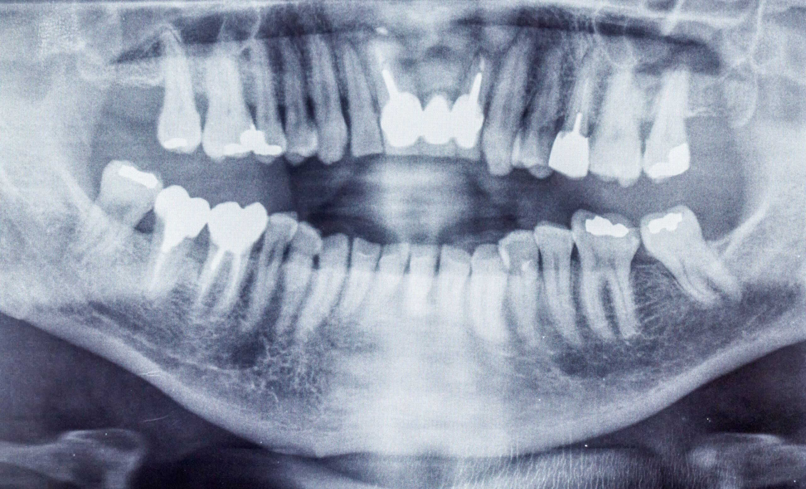 Formation CBCT dentaire : sécuriser vos diagnostics en omnipratique