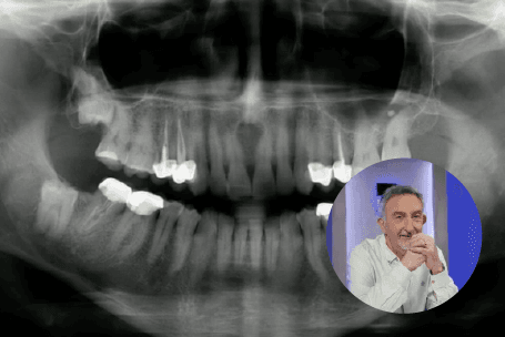 Formation CBCT obligatoire : ce que dit la réglementation en 2026