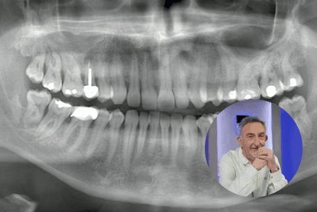 Formation Radioprotection — Dr Yves Ponchet
